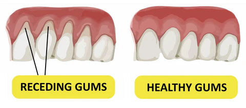 Soft Vs. Traditional Toothbrush: Which One Should You Use?